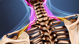 Forward Head Posture's Effect on the Cervical Spine