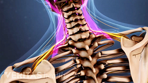 Medical illustration of the head and upper back. Muscles and nerves in the neck and upper shoulders are highlighted.