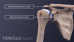 Medical illustration of the shoulder bones with the acromioclavicular (AC) joint and glenohumeral joint labeled