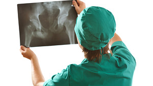 检查骨盆x光片的医生。