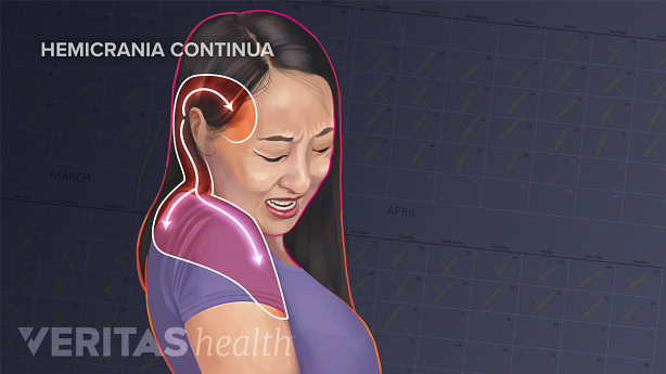 Woman wincing in pain from headache around the ear, through the neck and shoulder.