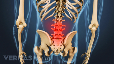 Posterior view of a skeleton with the lower spine highlighted in red to indicate pain