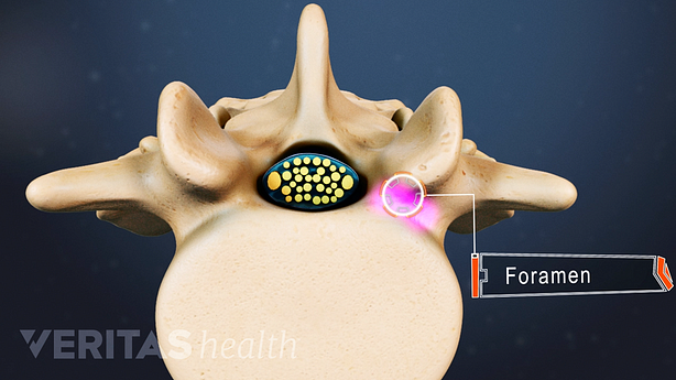 Transverse cross section of a vertebra with a foramen highlighted.