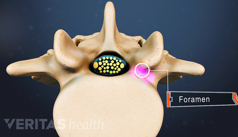 Transverse cross section of a vertebra with a foramen highlighted.