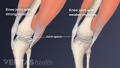 Do knee pillows really help? - Bone & Joint
