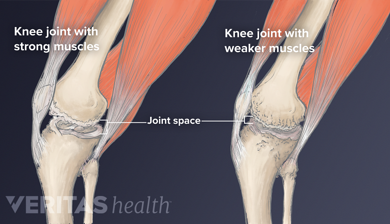 Knee Exercises for Arthritis