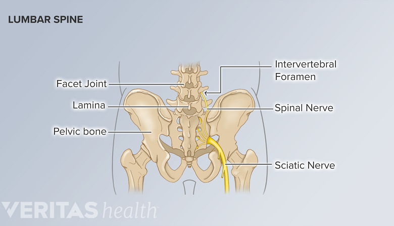 Posterior view of the pelvis labeling the facet joint, lamina, intervertebral foramen, pelvic bone, sciatic nerve, spinal nerve