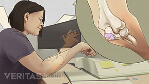Illustration of a woman sitting at a desk with her elbow on the table. Inset shows elbow bone structure with bursitis.