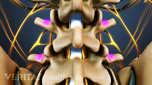 Posterior view of the spine showing spinal cord and nerve roots.