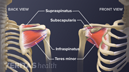 Tendons of the rotator cuff including the subscapularis, infraspinatus, teres minor, and supraspinatus.