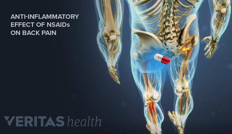Illustration showing effects of NSAIDs on low back pain.