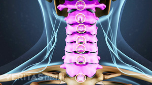 Posterior view of the neck with cervical vertebrae highlighted