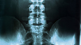 X-ray view of the lumbar spine and pelvis.