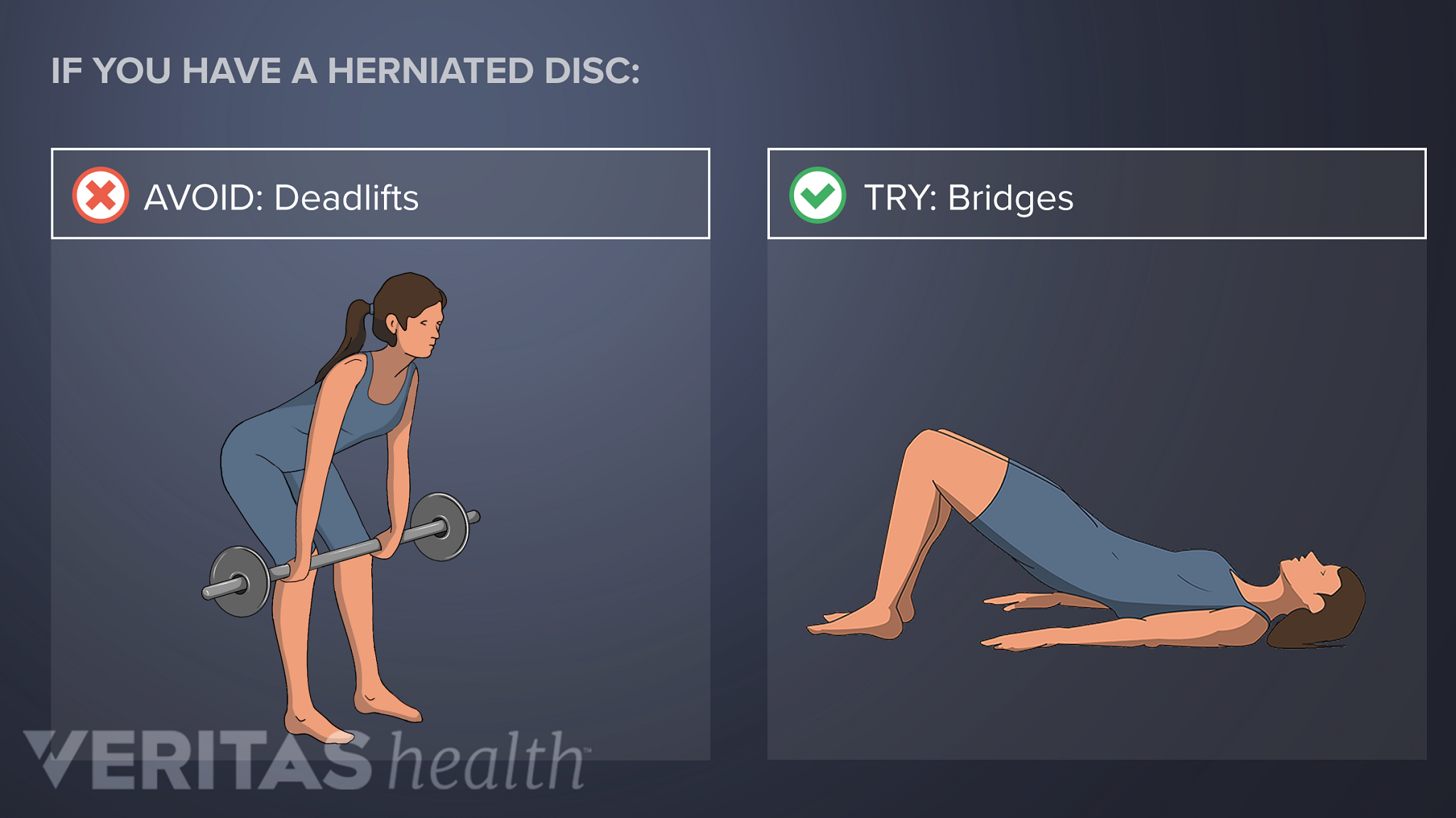 Herniated Disc Physical Therapy: What to Expect and Exercises