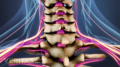 Medical illustration of the spinal cord and nerves in the cervical spine