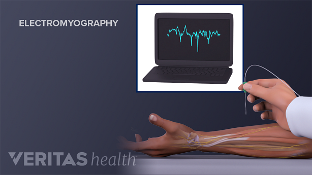 Administering a needle test on a forearm with the computer monitor results in the background.