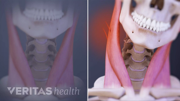 3D image of neck muscle.