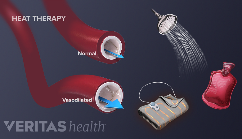 The effect of different heat therapies on blood vessels.