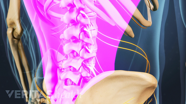 Anatomía de la distensión muscular de la espalda baja