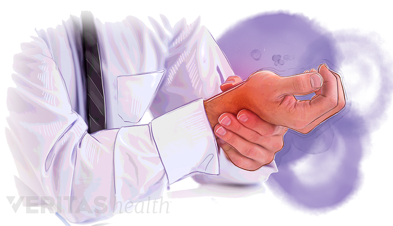An illustration of a man with wrist pain.