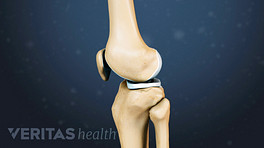 健康膝盖的骨骼视图