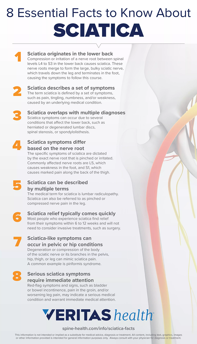 What is Sciatica and how do you treat Sciatic nerve pain?