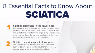 8 Essential Facts to Know About Sciatica