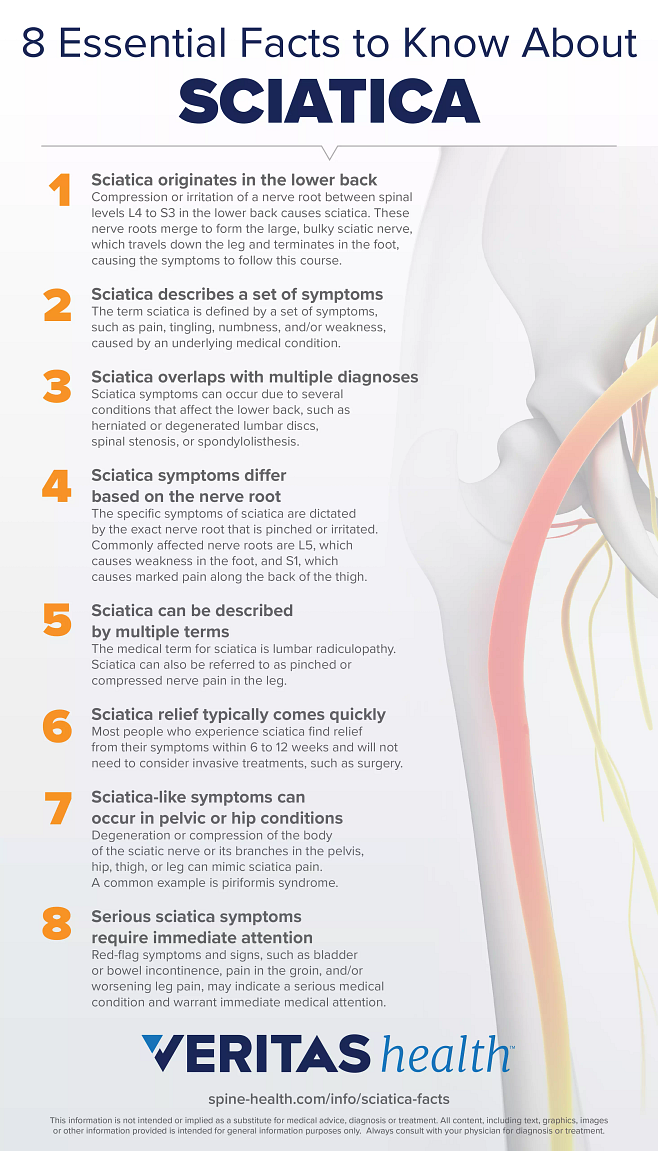 Sciatic Nerve Pain