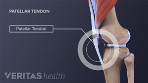 Profile view of the knee labeling the patellar tendon.