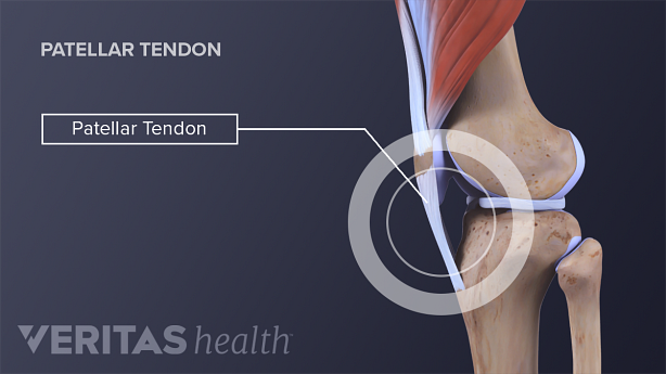 Illustration of the Patellar tendon