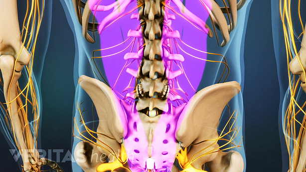 Medical illustration of the lumbar spine, the muscles that are separated during a lumbar laminectomy are highlighted
