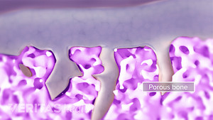 Up close image of porous bone.