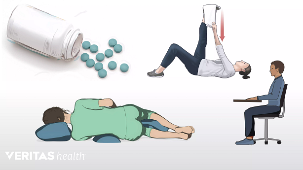An illustration showing various nonsurgical treatment methods.