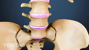 Anterior view of the pelvis highlighting the intervertebral discs in the lumbar spine.
