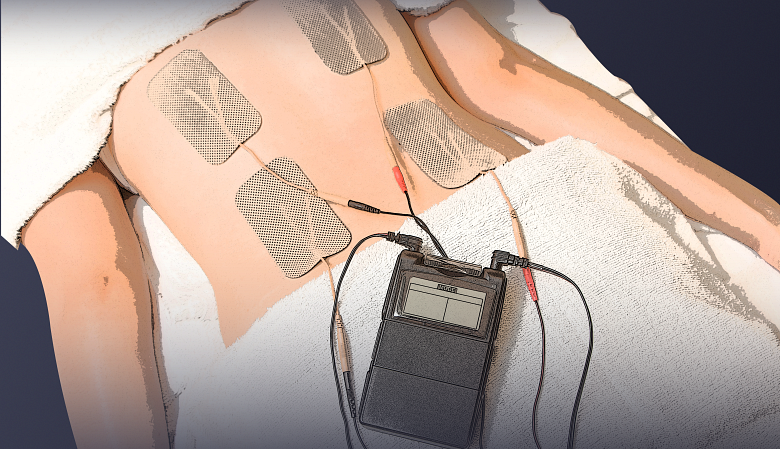 An image showing TENs device electrodes on back muscle.