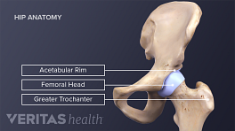 Medical illustration of the hip joint including the acetabular rim, femoral head, greater trochanter