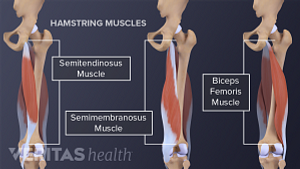 Hamstring anatomy showing the muscles and bones.
