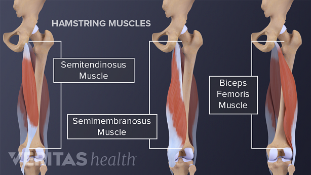 Hamstring Muscles including semitendionosus, semimembranosus, and biceps femoris muscles.