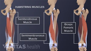 Hamstring Stretching Exercises for Sciatica Pain Relief