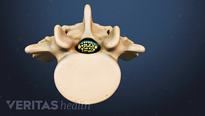Superior view of a lumbar vertebra with a normal spinal canal.