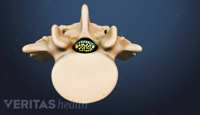 Transverse cross section view of a lumbar vertebra and spinal canal.