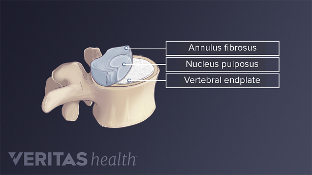 Illustration showing anatomy of lumbar vertebra.