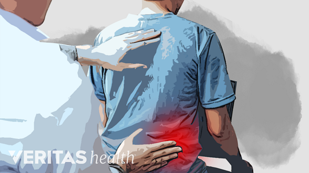 An illustration showing a doctor examining a persons lower back pain highlighted in red.