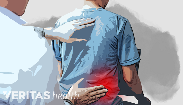An Illustration showing a doctor evaluating a persons back.