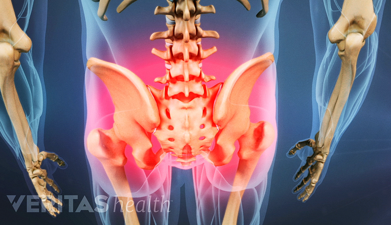 Tensión muscular y dolor en la pelvis y la parte inferior de la espalda.