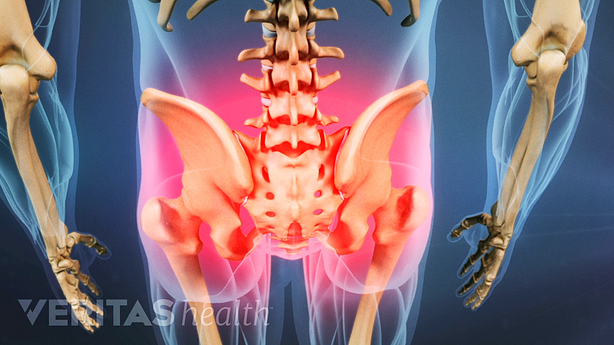 Tensión muscular y dolor en la pelvis y la parte inferior de la espalda.