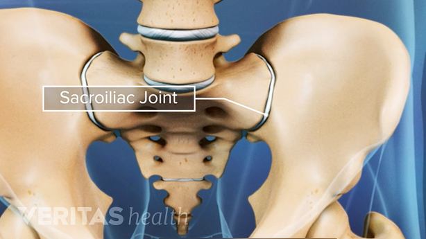 Illustration of the SI joint in the pelvis.