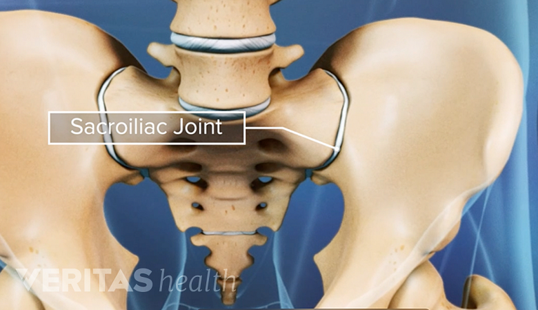 Illustration of the SI joint in the pelvis.