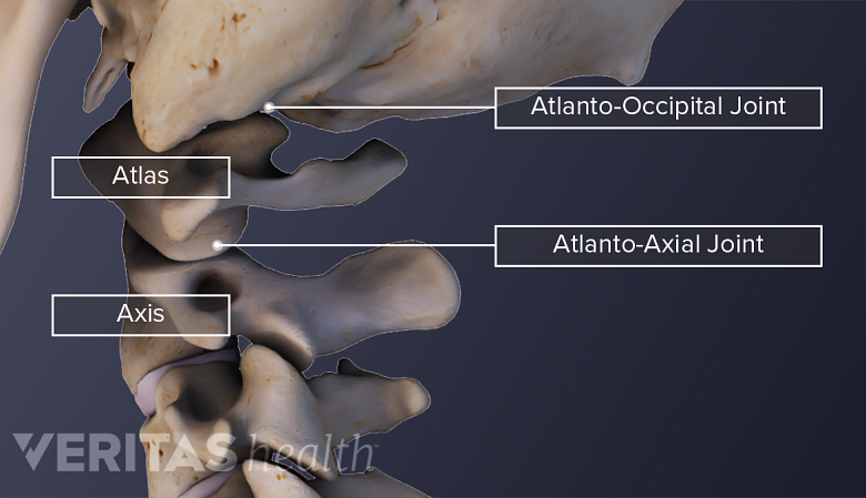 Medical illustration showing cervical spine anatomy showing C1 and C2.