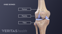 View of the knee labeling the femur, patella, tibia.